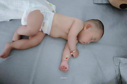 扶余六个月宝宝眼睛散光